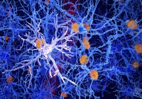 Các nhà khoa học tìm thấy nhóm tế bào não có thể ngăn chặn bệnh Alzheimer