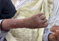 Người phụ nữ bị ngứa dữ dội đến mức “ảo giác có sâu bò”: Nguyên nhân gây sốc từ thói quen nhiều người Việt vẫn làm