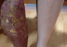 Bức ảnh làm 50 triệu người bật cười, nhưng lại khiến mẹ tôi khóc nức nở