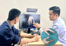 BV Việt Đức tạo nên kỳ tích đầu tiên tại Việt Nam: cứu sống ngón tay bị đứt rời sau 25 giờ