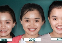 Nha khoa Platinum Dental và hành trình 10+ năm chăm sóc nụ cười gia đình