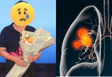 1 'Táo Quân' bị ung thư phổi, tình trạng hiện tại khiến nhiều người xót xa