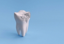 Các nhà khoa học phát mình loại gel giúp tái tạo men răng chỉ trong vài tuần 