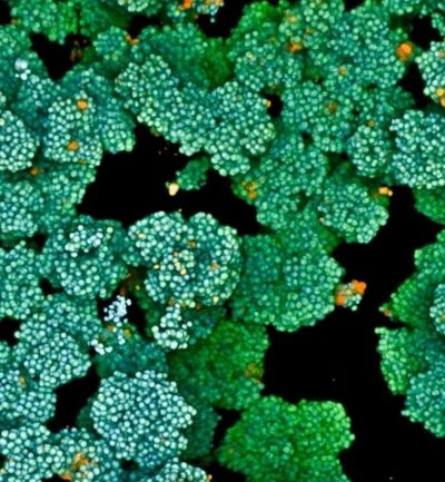 Singapore tìm ra giải pháp mới vô hiệu vi khuẩn kháng thuốc, đẩy nhanh quá trình lành vết thương mạn tính