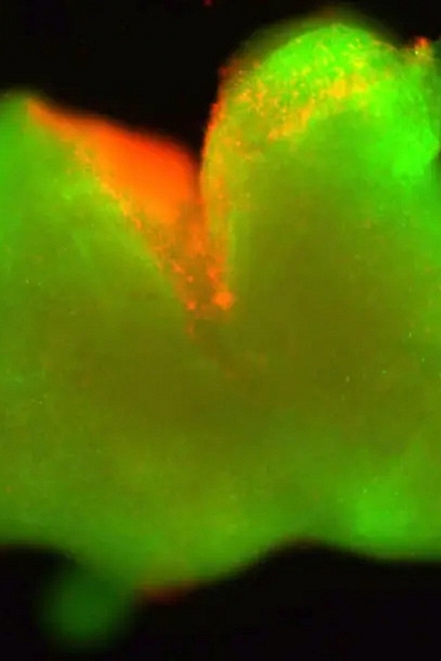 Lần đầu thành công tạo ra tủy sống nhân tạo, mở ra hy vọng mới cho người bị liệt