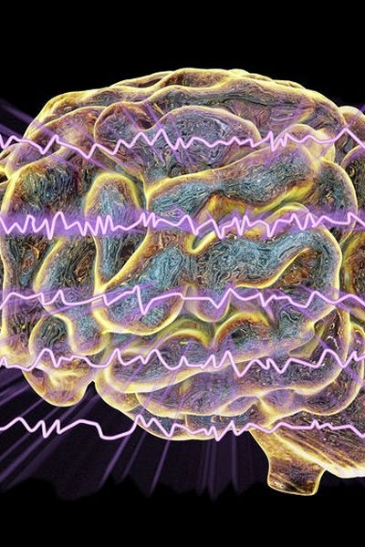 Loại thuốc mới đem lại hy vọng cho trẻ mắc hội chứng động kinh hiếm gặp