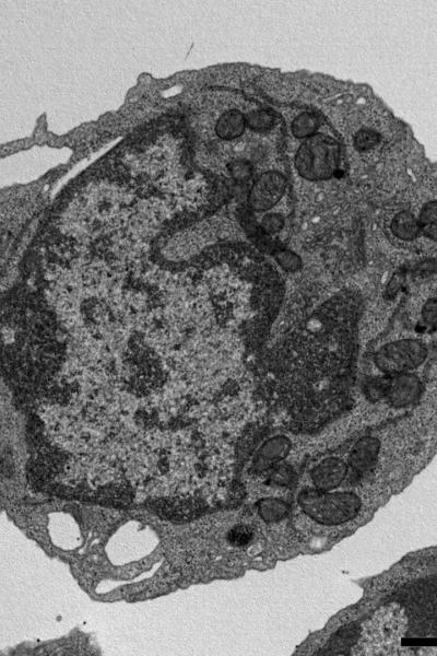 Phát hiện protein có thể nắm giữ chìa khóa giúp làm chậm quá trình lão hóa từ gốc