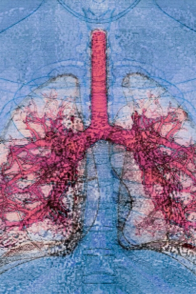 Mỹ thực hiện thành công ca ghép đa tạng từ người nhiễm HIV sang người nhiễm HIV đầu tiên trên thế giới