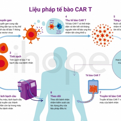 CAR-T: Đột phá điều trị ung thư máu nhưng không dành cho tất cả