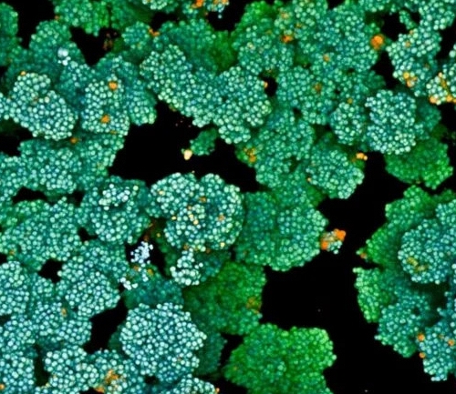 Singapore tìm ra giải pháp mới vô hiệu vi khuẩn kháng thuốc, đẩy nhanh quá trình lành vết thương mạn tính