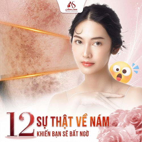 Giải pháp trị nám sinh học chuyên sâu không laser tại Phòng khám Anna Sasa