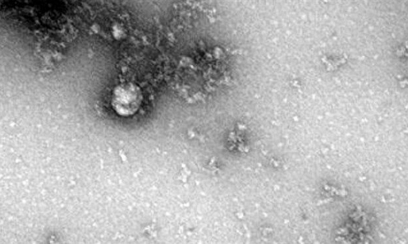 Vì sao biến chủng SARS-CoV-2 lây lan nhanh ở Việt Nam?