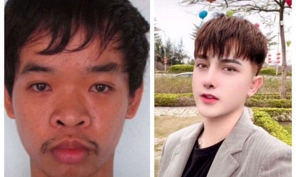 Báo Malaysia 'bái phục' chàng trai Việt chi ra 400 triệu đồng để phẫu thuật...vì bị chê xấu khi đi xin việc