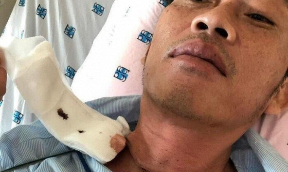 Hoài Linh phẫu thuật u ác tuyến giáp, hai lần xạ trị