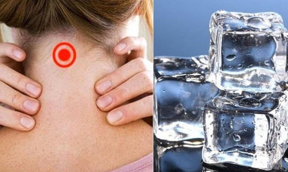 5 lợi ích không ngờ của việc đặt đá lạnh lên cổ