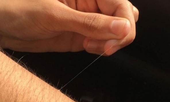 Tại sao cơ thể chúng ta có một số sợi lông mọc dài bất thường?