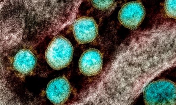 Phát hiện siêu kháng thể chống được 23 biến chủng COVID-19