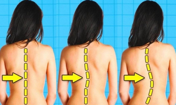 8 hoạt động hàng ngày có thể làm hỏng cột sống của bạn
