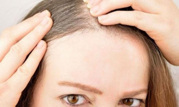 Tại sao nhiều người trẻ lại có tóc bạc sớm?