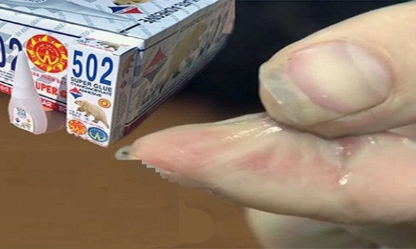 Mẹo tẩy keo 502 dính vào da đơn giản và an toàn