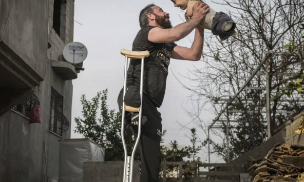 Khoảnh khắc buồn vui lẫn lộn về bức ảnh hai cha con bị mất tứ chi do nội chiến ở Syria