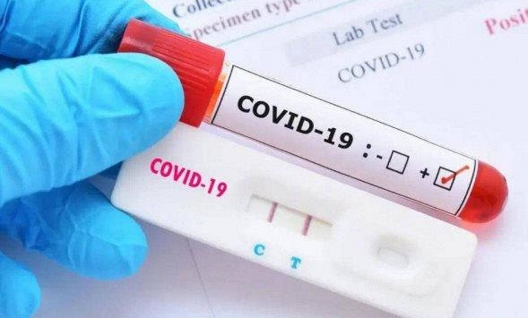 TP.HCM, Kiên Giang kiểm tra đột xuất việc mua bán kit test COVID-19