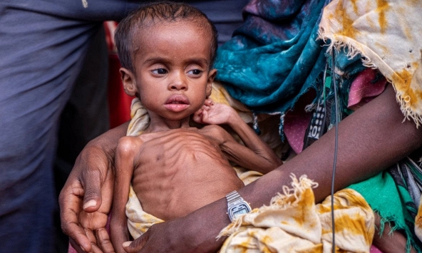 Chiến tranh ở Ukraina làm cho nạn đói ở Somalia trở nên tồi tệ hơn