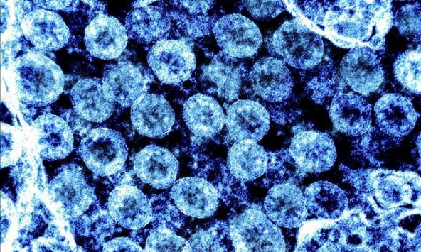 Dòng phụ mới BA.4 và BA.5 có thể gây làn sóng lây nhiễm mới