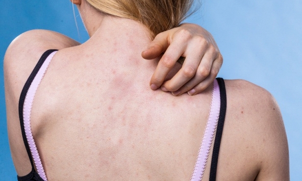 Tại sao chúng ta không nên mặc cùng một bộ quần áo trong 2 ngày liên tiếp