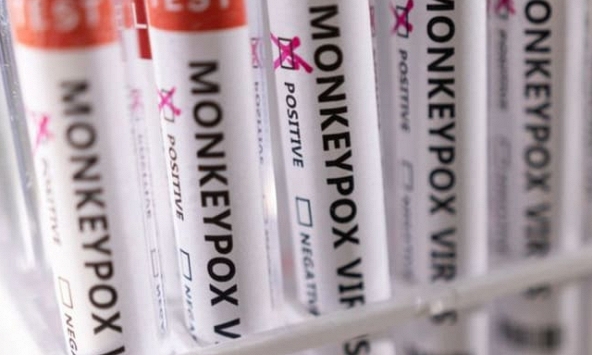 WHO: Chưa cần tiêm phòng hàng loạt bệnh đậu mùa khỉ