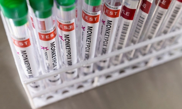 WHO cho biết bệnh đậu mùa khỉ chưa phải là trường hợp khẩn cấp về sức khỏe