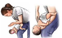 Bị hóc cùi dừa, bé 17 tháng tuổi tử vong