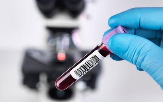 Trứng gà có thể chống lại sự lây nhiễm của coronavirus?