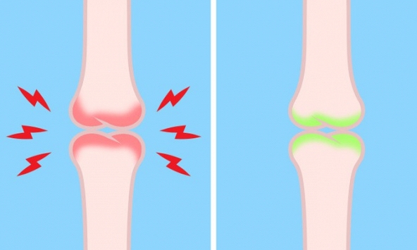 6 dấu hiệu cảnh báo bạn đang thiếu vitamin D và cách khắc phụ