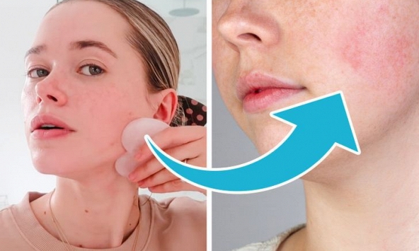 7 sản phẩm chăm sóc có thể gây hại cho da, rất nhiều người không biết