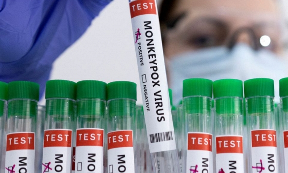 Bộ Y tế ban hành hướng dẫn về cách phòng chống bệnh đậu mùa khỉ