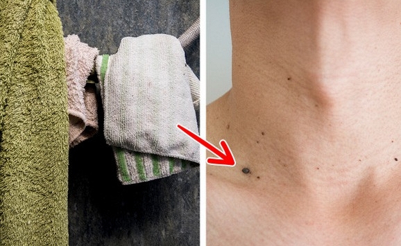 6 cách ngăn ngừa mụn cóc hiệu quả, bạn nên thử