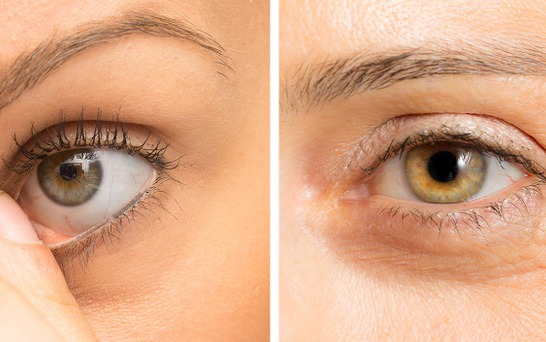 Làn da sẽ lão hóa nhanh hơn nếu bạn không bỏ 6 thói quen tưởng chừng như vô hại này