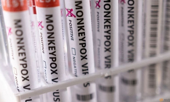 Indonesia là nước Đông Nam Á mới nhất ghi nhận đậu mùa khỉ