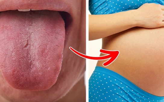 6 dấu hiệu mang thai đáng ngạc nhiên bạn có thể không biết