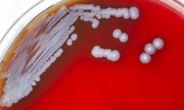 Nhiễm khuẩn là 'nguyên nhân gây tử vong thứ hai trên toàn thế giới'