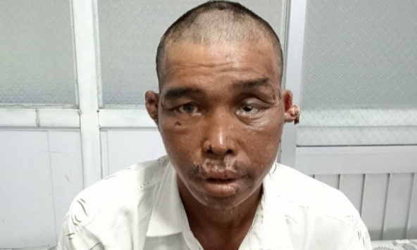 Chưa liên lạc được nạn nhân còn lại vụ ngư dân bị hành hạ trên tàu cá