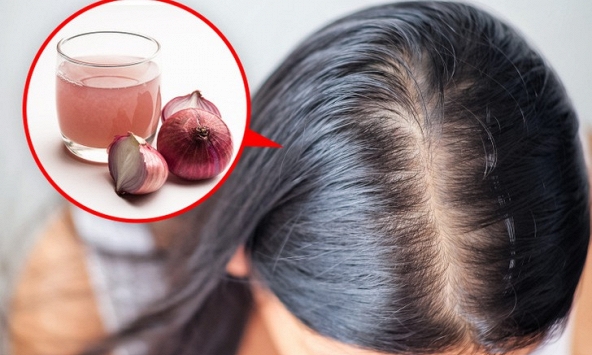8 biện pháp khắc phục tình trạng rụng tóc