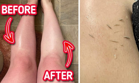 7 sản phẩm làm đẹp loại bỏ các vấn đề về da ngay lập tức