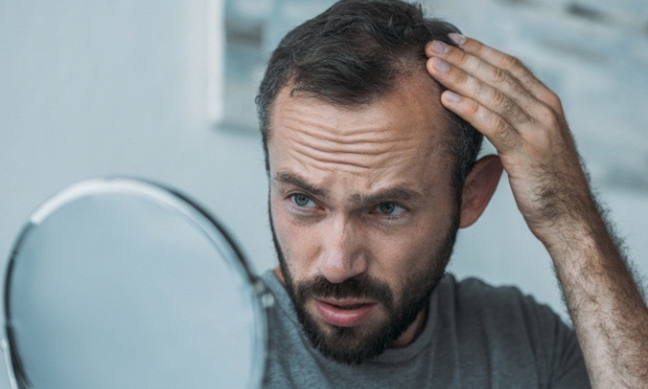 Nhà khoa học phát hiện nước tăng lực và cà phê gây rụng tóc ở nam giới