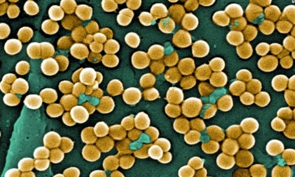 Vụ 72 học sinh ngộ độc do món gà nhiễm khuẩn tụ cầu vàng, làm sao để phòng tránh?