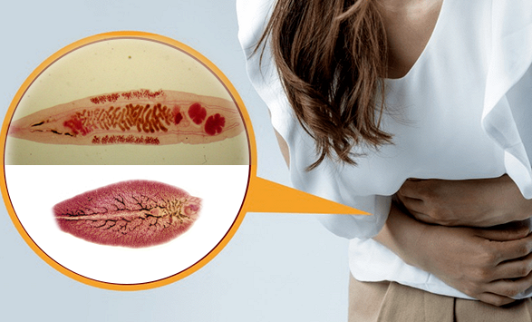 Số người nhập viện do sán lá gan tăng cao bất thường