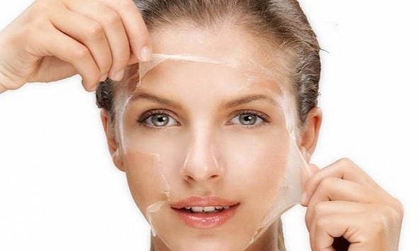 Peel da có thật sự 'thay da đổi thịt' hay lột luôn nhan sắc?