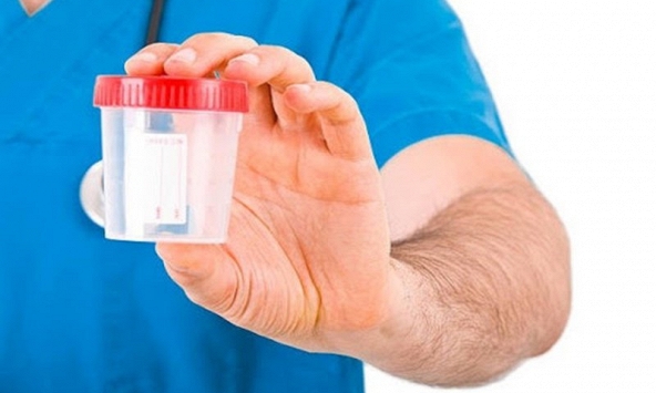 Nước tiểu màu trắng đục như sữa báo hiệu bệnh về tiết niệu nguy hiểm