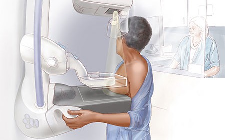 Mỹ khuyến nghị phụ nữ độ tuổi 40 nên tầm soát ung thư vú định kỳ